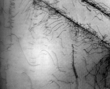 DISCORDÂNCIAS VISTAS ATRAVÉS DE MICROSCOPIA  ELETRÔNICA DE   TRANSMISSÃO